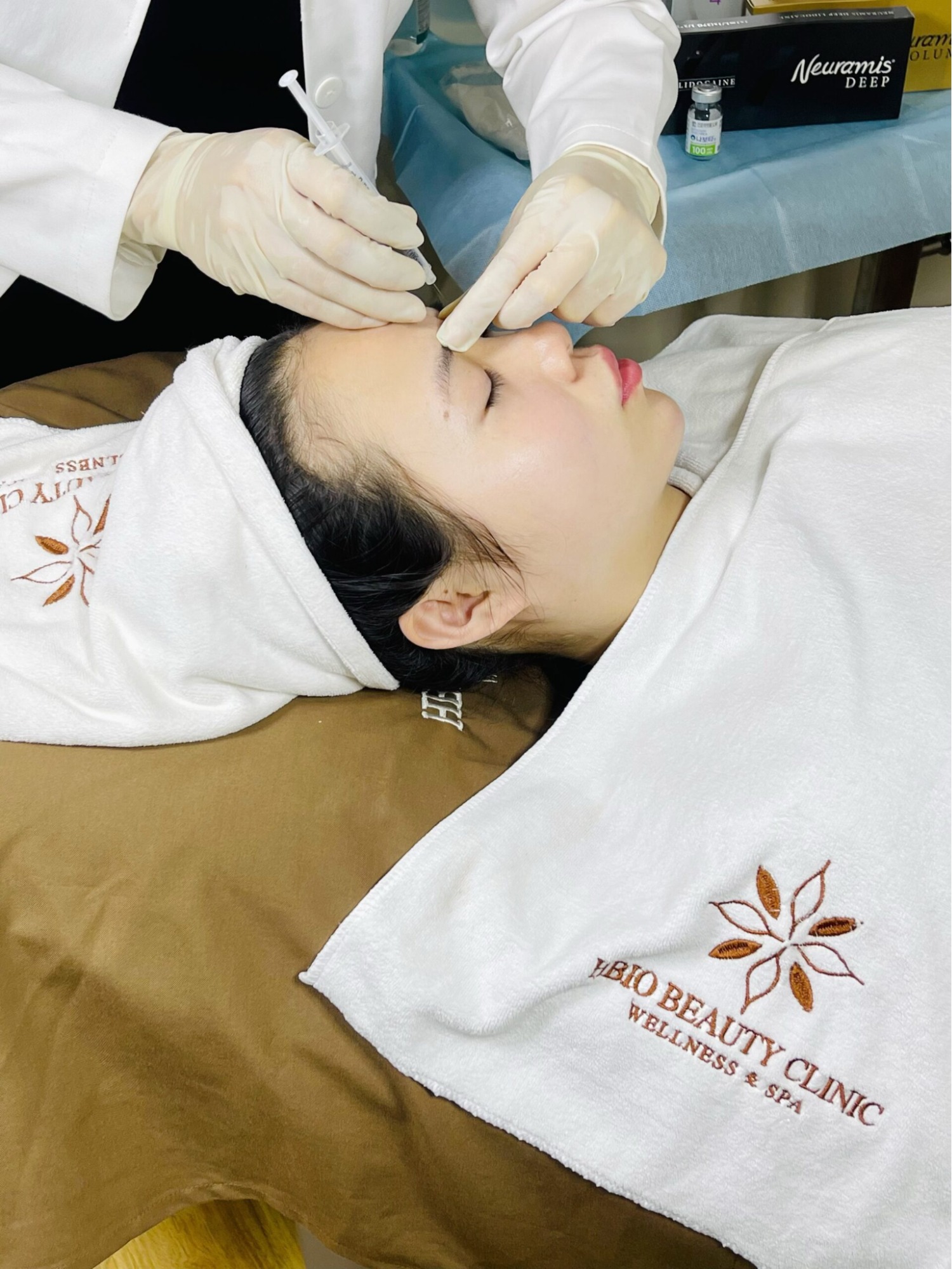 Phương pháp tiêm botox và HA giúp điều trị mí mắt bị nhăn