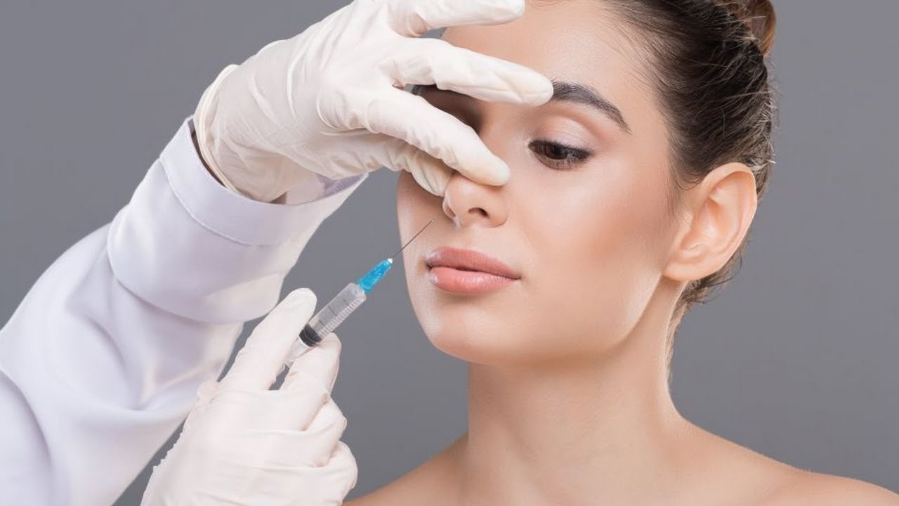 Hiệu quả và thời gian duy trì của tiêm filler mũi