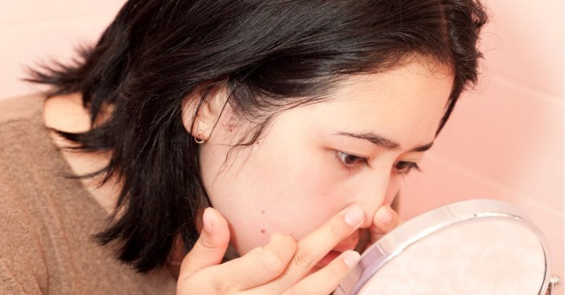 Tăng nguy cơ hoại tử mô mềm nguy hiểm