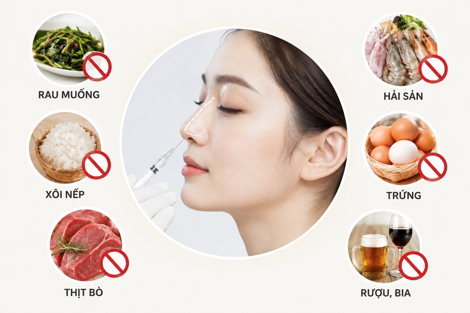 Tiêm Filler mũi kiêng ăn gì để tránh sẹo và sưng?  
