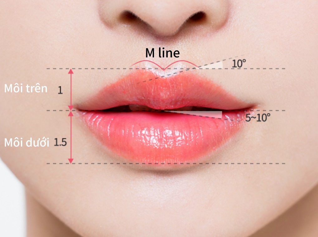 Thời gian duy trì hiệu quả của phương pháp tiêm filler môi cười