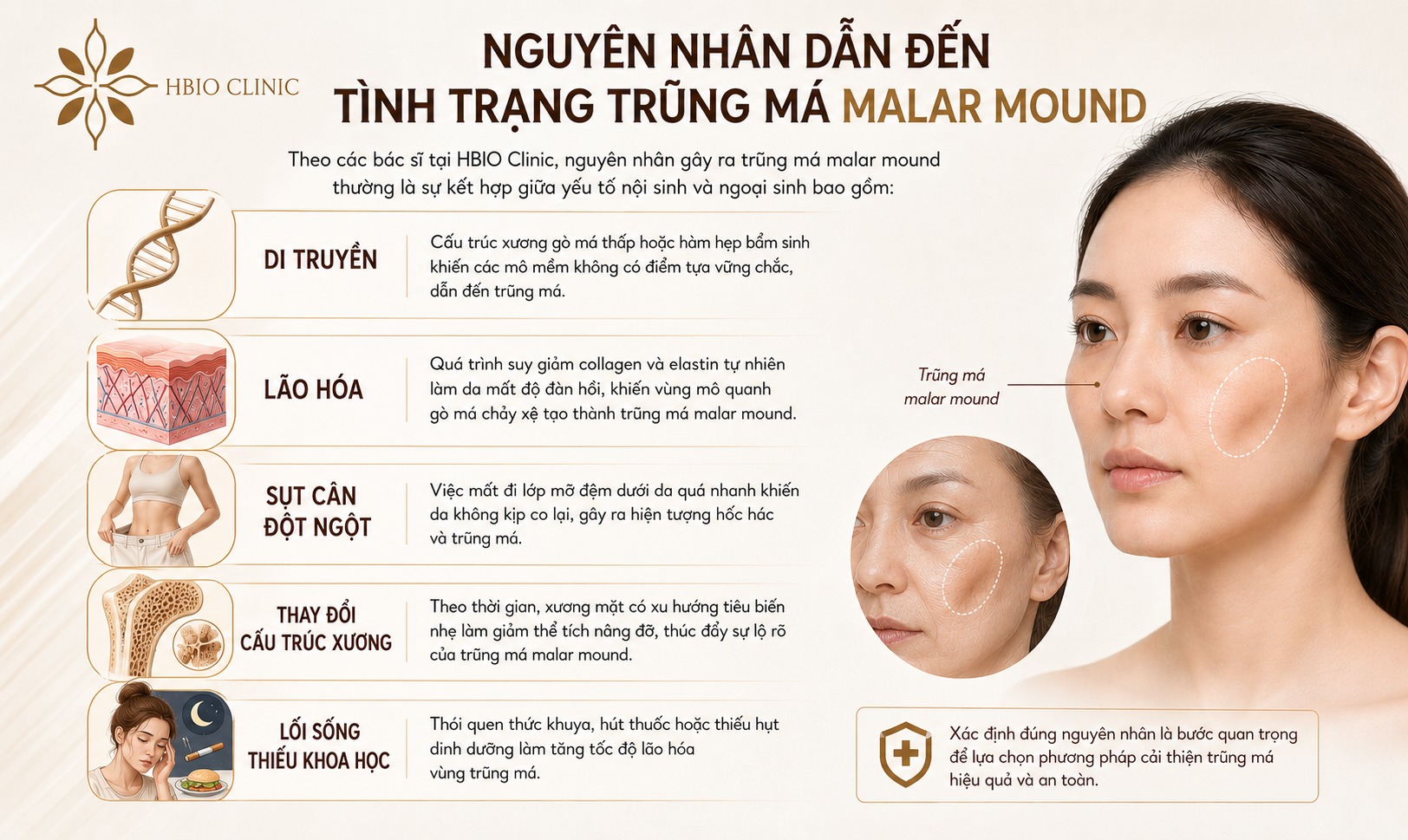 Nguyên nhân dẫn đến tình trạng trũng má