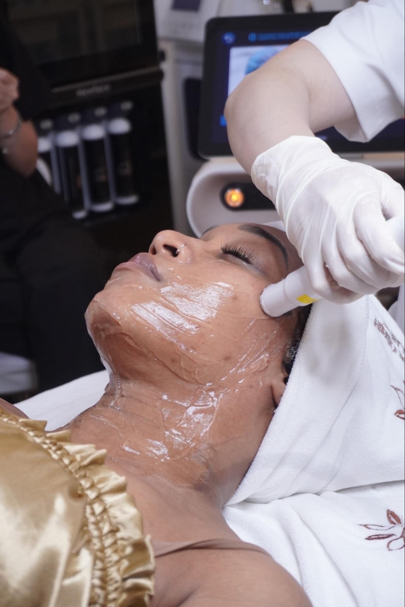 Phương pháp nâng cơ Ultherapy là gì?