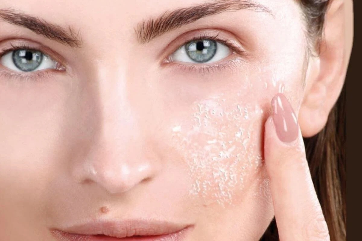 Giải đáp da khô có nên peel da không?