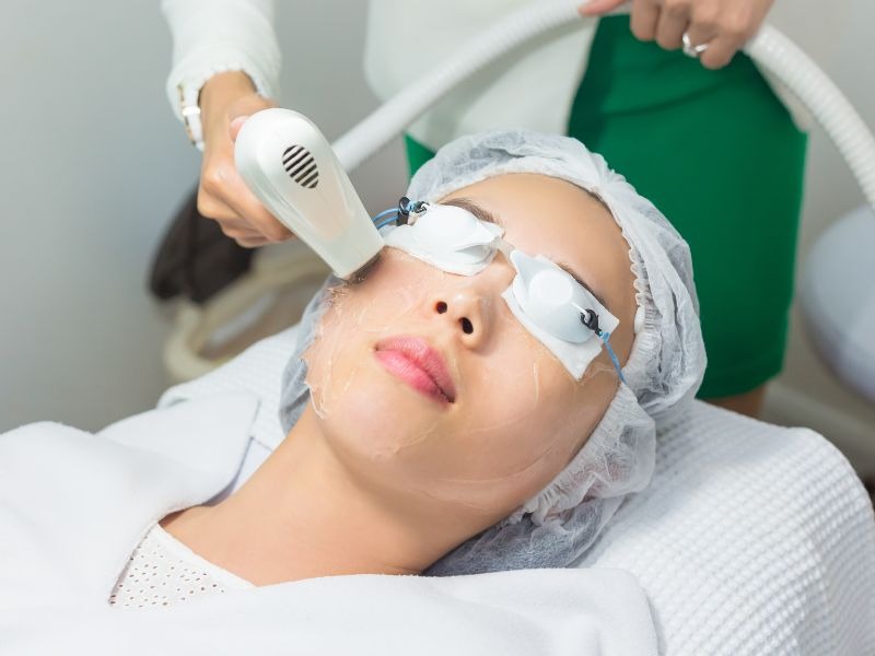 Sai lầm cần tránh khi chăm sóc da sau laser
