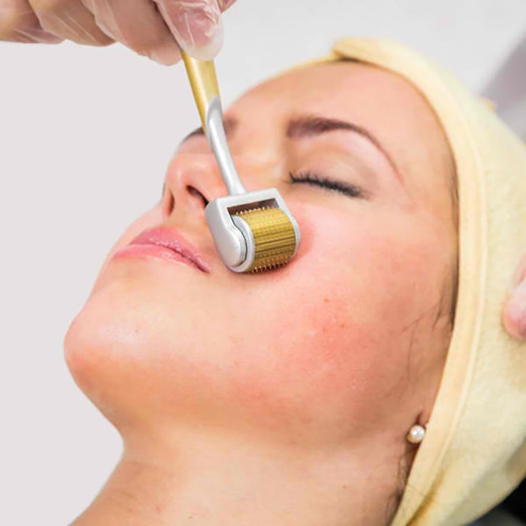 Ưu điểm của liệu pháp lăn kim thu nhỏ lỗ chân lông