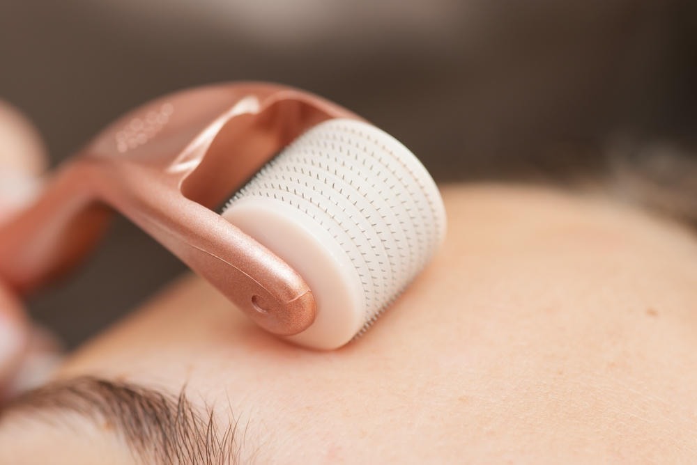 Giải thích cơ chế và giải đáp liệu lăn kim có thu nhỏ lỗ chân lông không