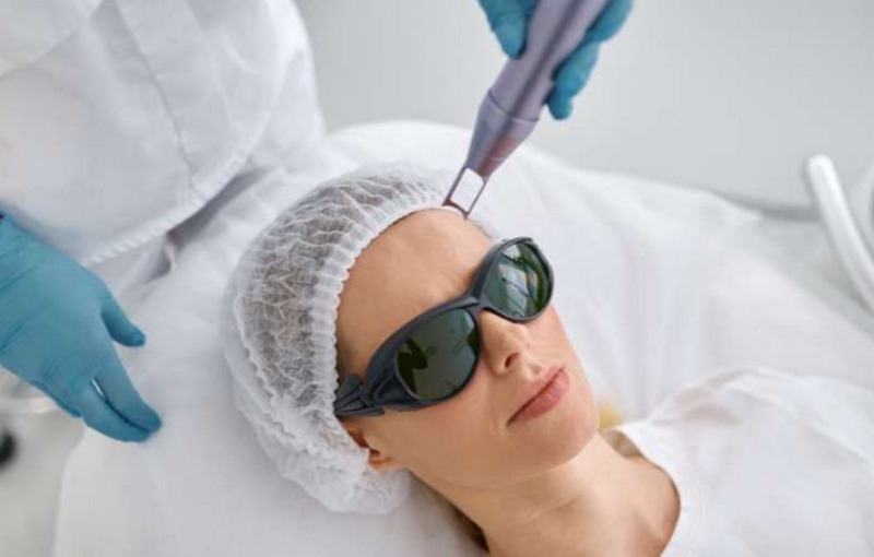 Ưu điểm của công nghệ Laser Toning