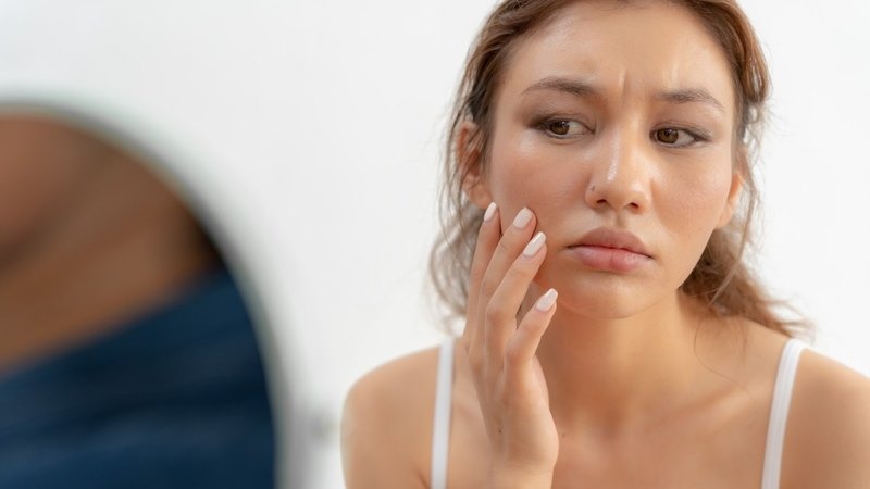 Người có làn da xỉn không đều màu