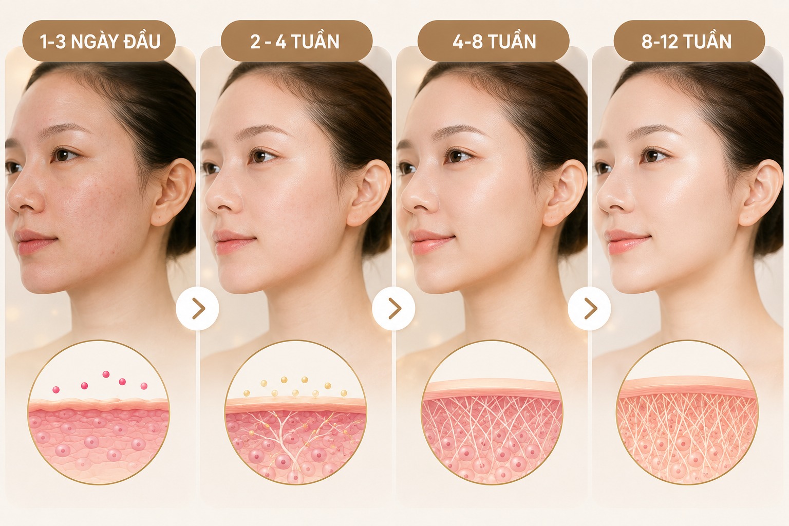 Giai đoạn 2: Khoảng 2 - 4 tuần sau tiêm