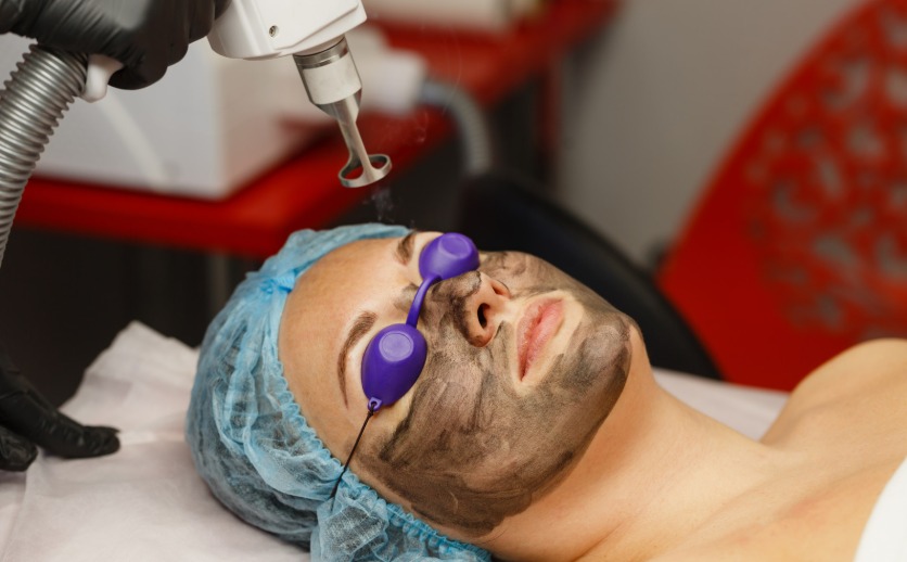 How many treatment sessions are needed for inflammatory acne to fully improve?