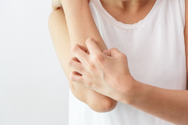 Tình trạng da bị nổi sần như da gà có nguy hiểm không?