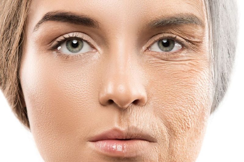 Kết quả phục hồi da săn chắc duy trì được trong bao lâu?