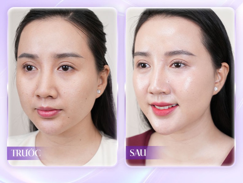 Đang cho con bú có thể thực hiện liệu trình chuyên sâu tại HBIO Clinic không?