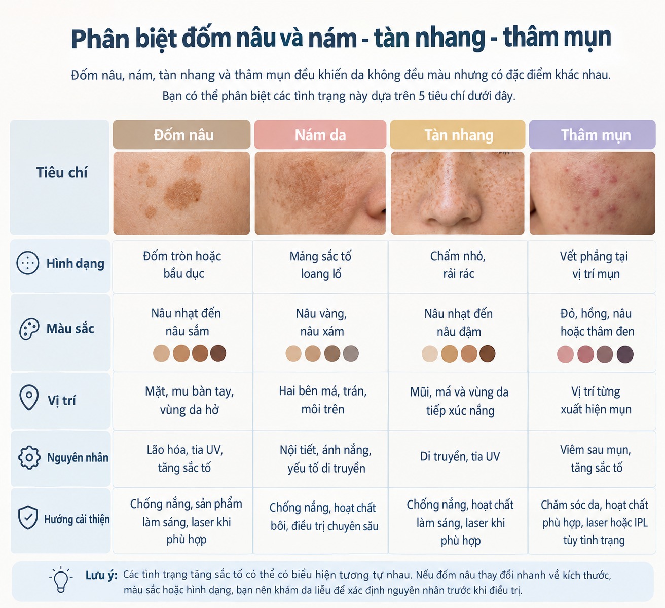 Phân biệt đốm nâu và nám - tàn nhang - thâm mụn