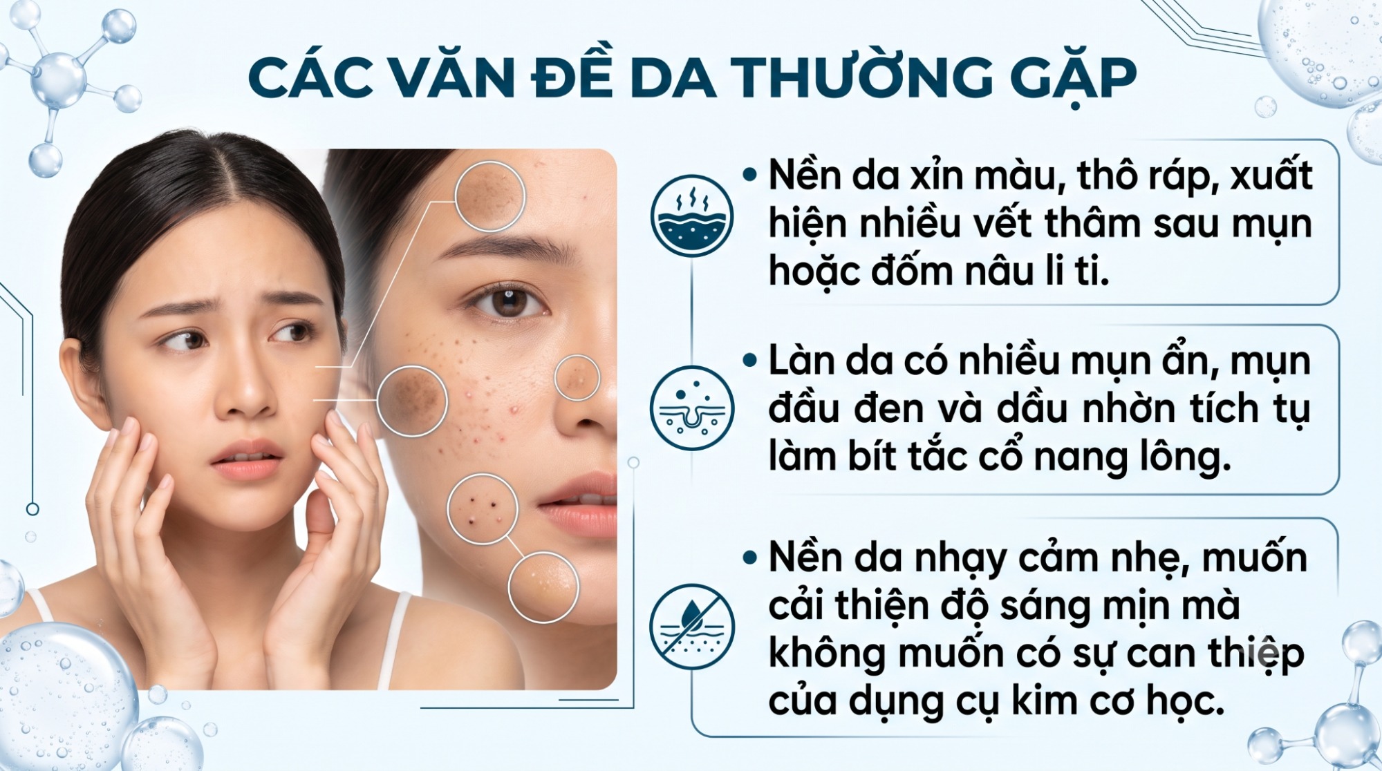 Trường hợp nên chọn peel da