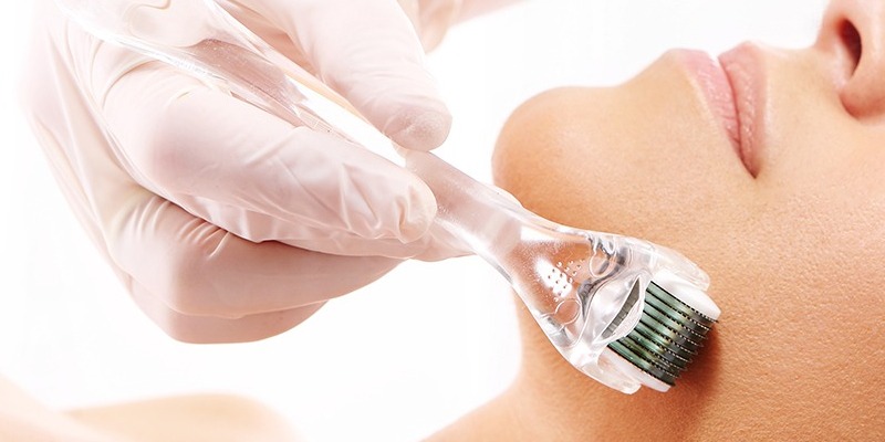 Trường hợp nên chọn lăn kim
