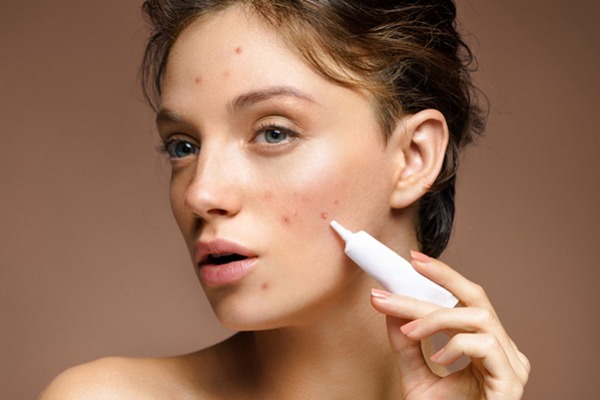 Sử dụng mỹ phẩm cấp ẩm có làm tình trạng mụn nặng hơn không?