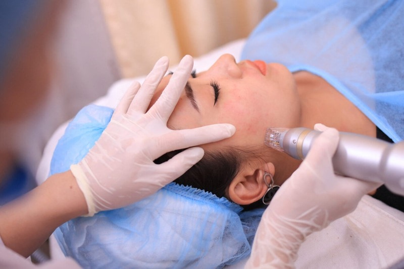 Chi phí điều trị nám chân đinh tại HBIO Clinic là bao nhiêu?