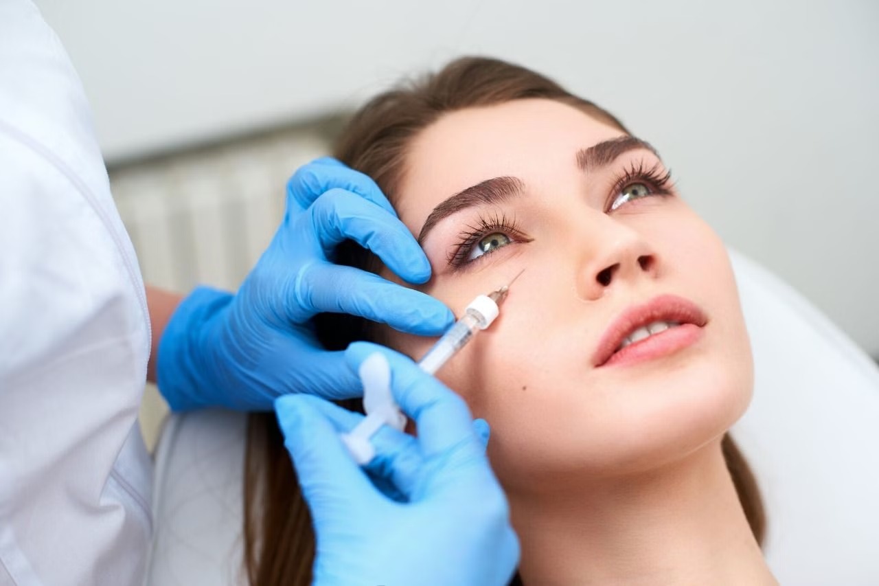 Tiêm chất kích thích tăng sinh collagen (Biostimulator)