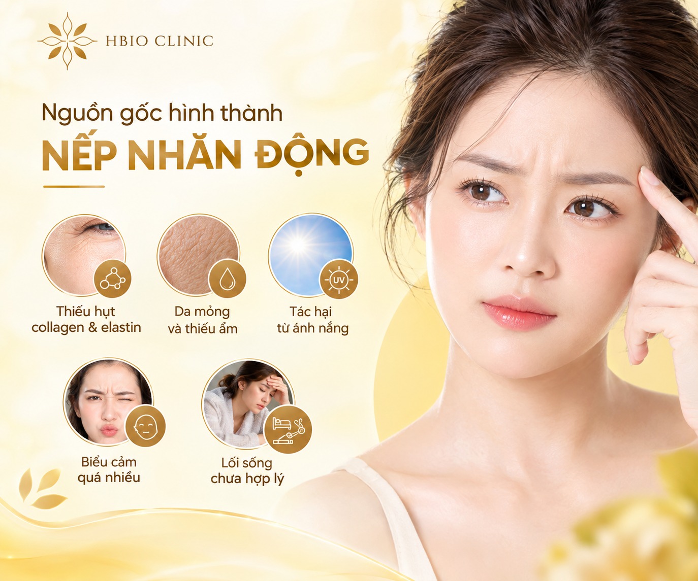 Nguồn gốc hình thành nếp nhăn động