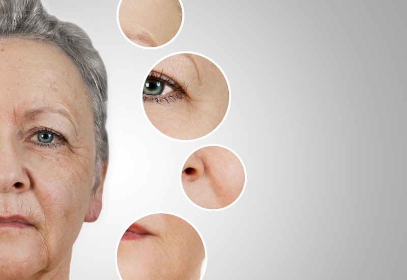 Có nên kết hợp tiêm filler và công nghệ nâng cơ cùng lúc không?