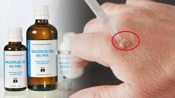 Axit salicylic
